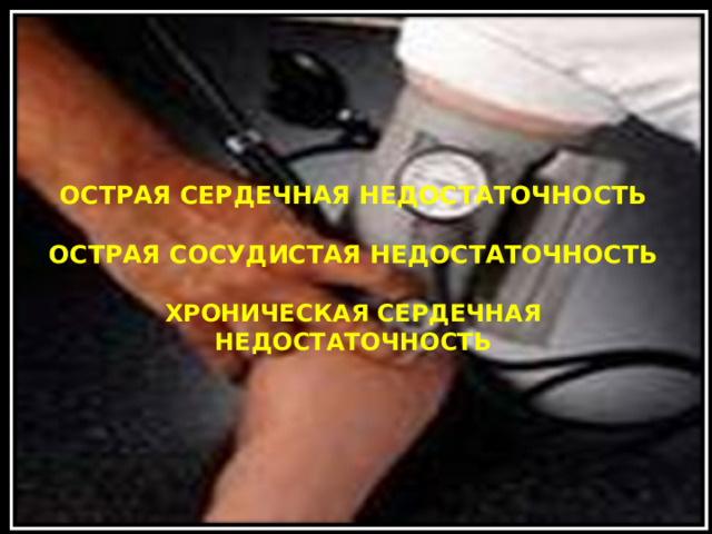 ОСТРАЯ СЕРДЕЧНАЯ НЕДОСТАТОЧНОСТЬ   ОСТРАЯ СОСУДИСТАЯ НЕДОСТАТОЧНОСТЬ   ХРОНИЧЕСКАЯ СЕРДЕЧНАЯ НЕДОСТАТОЧНОСТЬ 