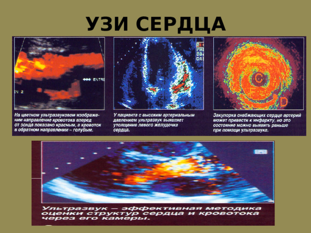 УЗИ СЕРДЦА 