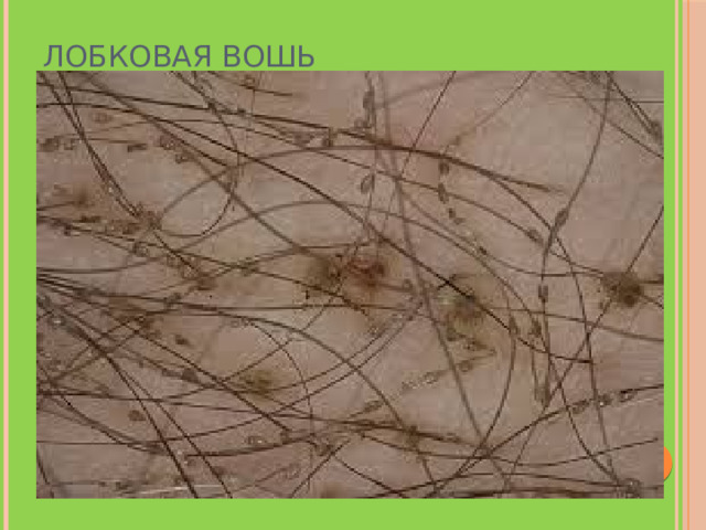 Лобковая вошь 