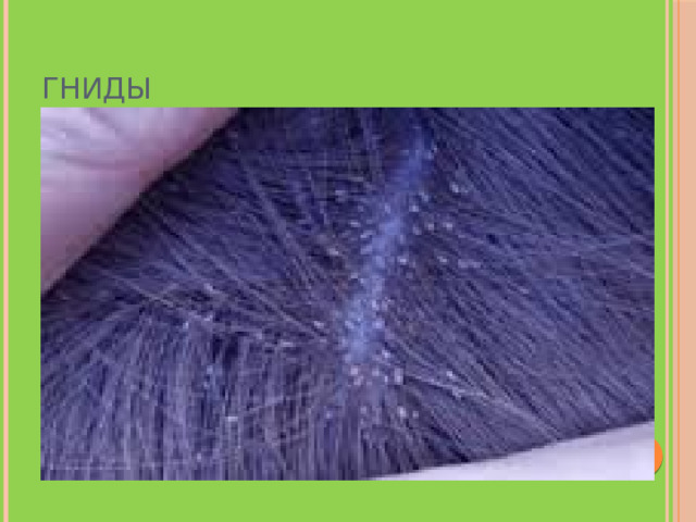 Гниды 