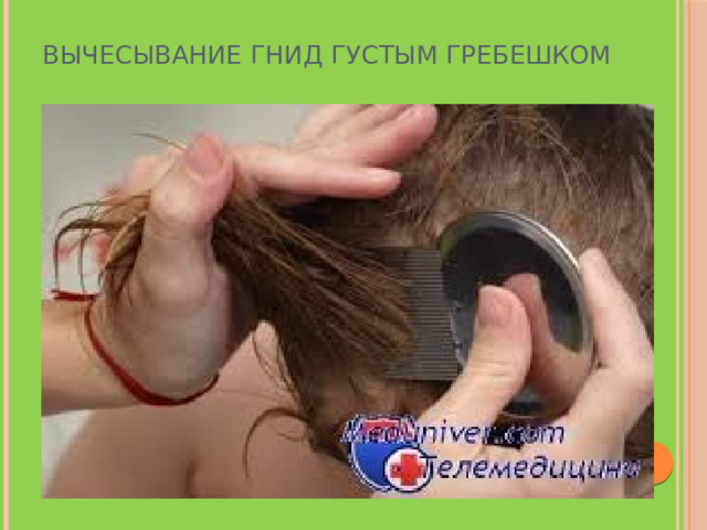 Вычесывание гнид густым гребешком 