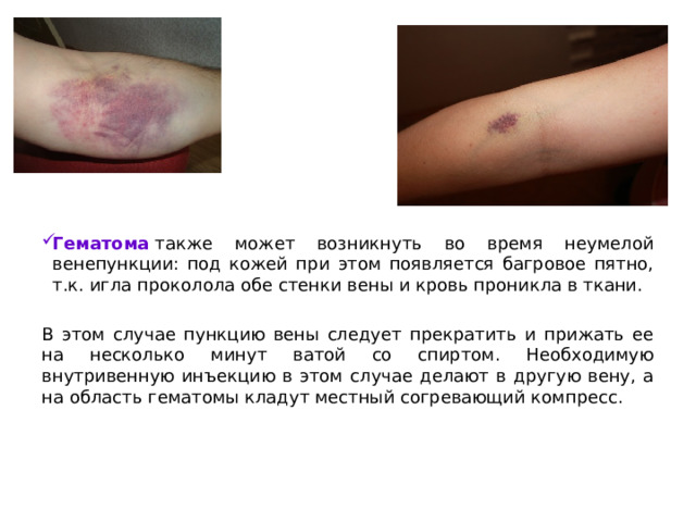 Постинъекционные осложнения