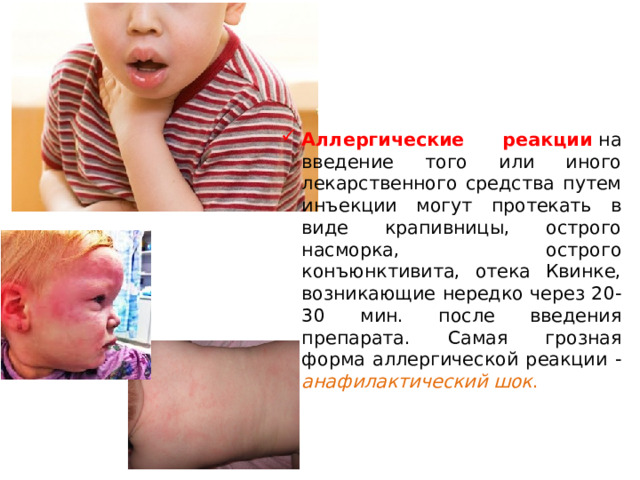 Аллергические реакции  на введение того или иного лекарственного средства путем инъекции могут протекать в виде крапивницы, острого насморка, острого конъюнктивита, отека Квинке, возникающие нередко через 20-30 мин. после введения препарата. Самая грозная форма аллергической реакции - анафилактический шок .  