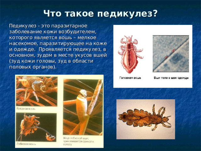 Что такое педикулез?     Педикулез - это паразитарное заболевание кожи возбудителем , которого является  вошь – мелкое насекомое, паразитирующее на коже и одежде.  Проявляется педикулез, в основном, зудом в месте укусов вшей (зуд кожи головы, зуд в области половых органов).     
