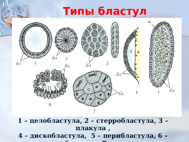 Типы бластул 1 – целобластула, 2 – стерробластула, 3 – плакула , 4 – дискобластула,   5 – перибластула, 6 – стомобластула, 7 – морула.   