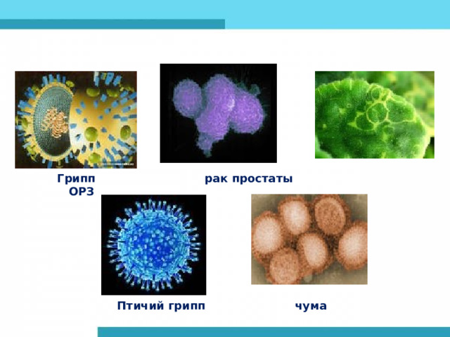 Грипп рак простаты ОРЗ Птичий грипп чума 