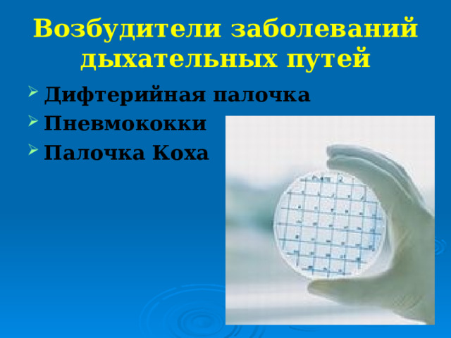 Возбудители заболеваний дыхательных путей Дифтерийная палочка Пневмококки Палочка Коха 