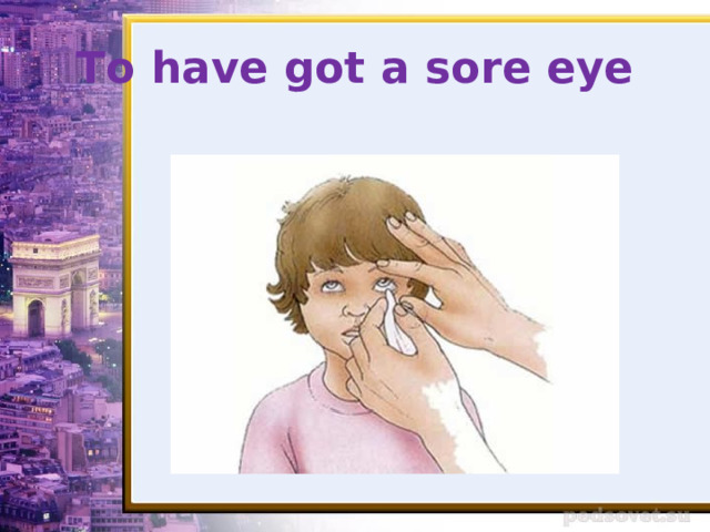 To have got a sore eye 