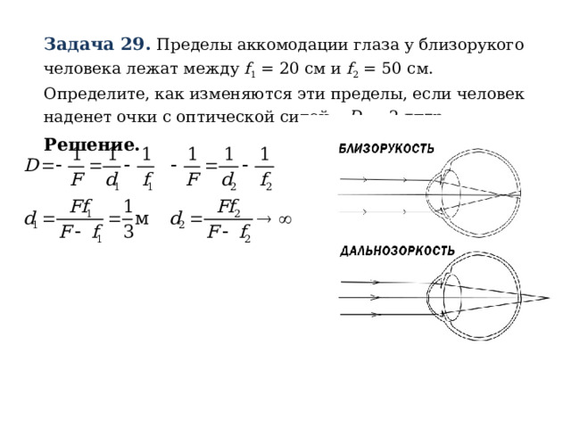 Задача 29.  Пределы аккомодации глаза у близорукого человека лежат между f 1 = 20 см и f 2 = 50 см. Определите, как изменяются эти пределы, если человек наденет очки с оптической силой –  D = 2 дптр. Решение. 