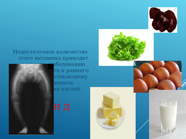 Недостаточное количество этого витамина приводит к рахиту - заболеванию детей грудного и раннего возраста, протекающему с нарушением образования костей. ВИТАМИН Д 