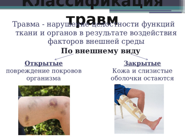 Классификация травм Травма - нарушение целостности функций ткани и органов в результате воздействия факторов внешней среды По внешнему виду Открытые Закрытые повреждение покровов организма Кожа и слизистые оболочки остаются целыми 