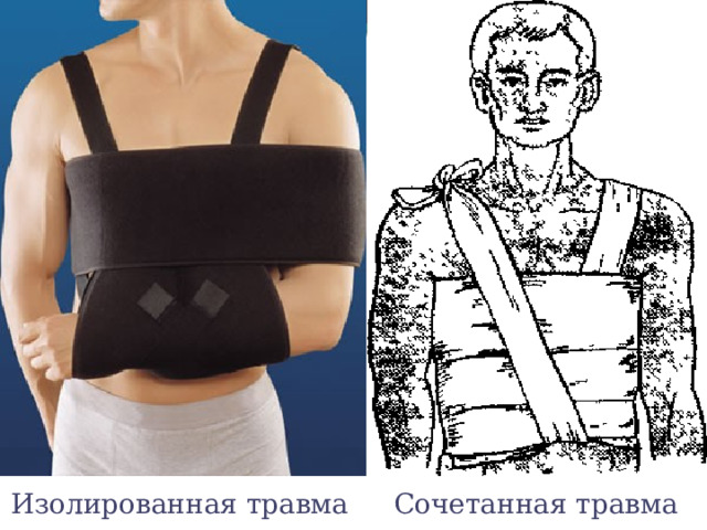 Изолированная травма Сочетанная травма 