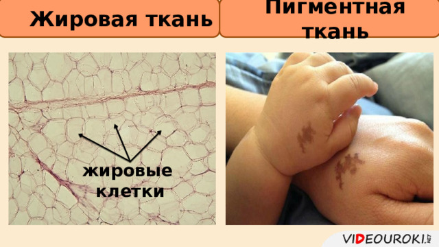 Пигментная ткань Жировая ткань         жировые клетки 