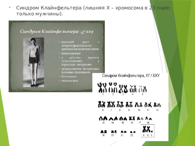 Синдром Клайнфельтера (лишняя Х – хромосома в 23 паре; только мужчины). 