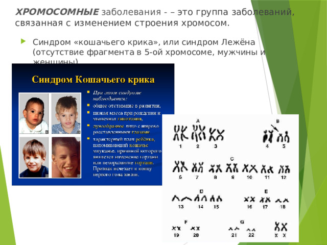 ХРОМОСОМНЫЕ заболевания - – это группа заболеваний, связанная с изменением строения хромосом.  Синдром «кошачьего крика», или синдром Лежёна (отсутствие фрагмента в 5-ой хромосоме, мужчины и женщины). 