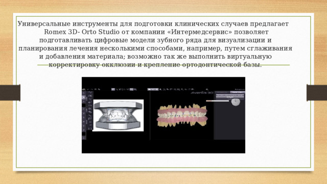 Универсальные инструменты для подготовки клинических случаев предлагает Romex 3D- Orto Studio от компании «Интермедсервис» позволяет подготавливать цифровые модели зубного ряда для визуализации и планирования лечения несколькими способами, например, путем сглаживания и добавления материала; возможно так же выполнить виртуальную корректировку окклюзии и крепление ортодонтической базы.   