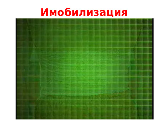 Имобилизация 