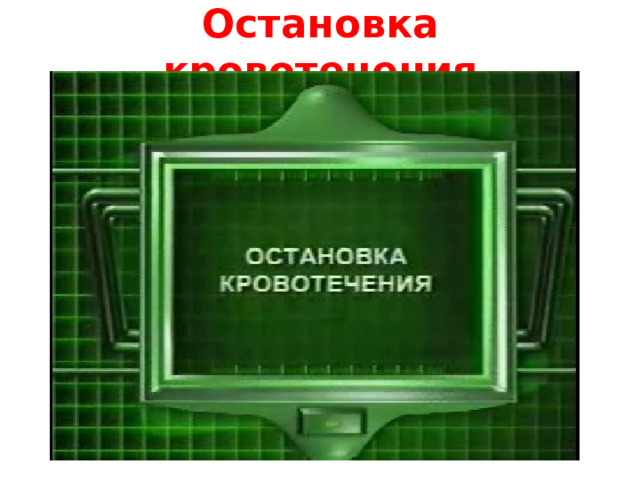 Остановка кровотечения 