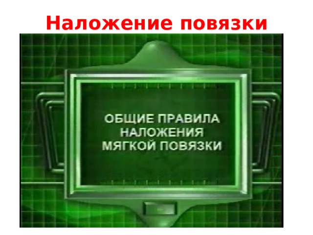 Наложение повязки 