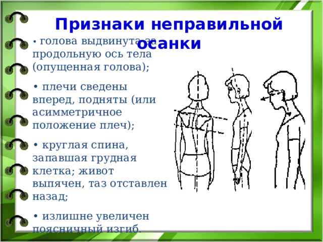 Признаки неправильной осанки • голова выдвинута за продольную ось тела (опущенная голова); • плечи сведены вперед, подняты (или асимметричное положение плеч); • круглая спина, запавшая грудная клетка; живот выпячен, таз отставлен назад; •  излишне увеличен поясничный изгиб. 