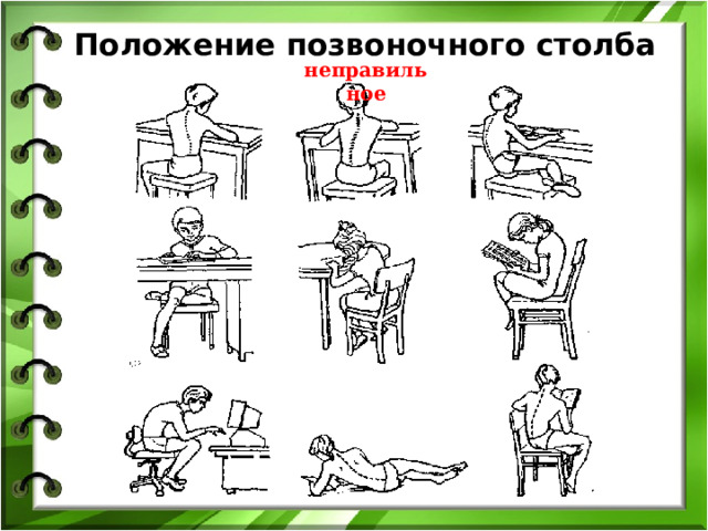 Положение позвоночного столба неправильное 