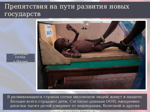Препятствия на пути развития новых государств Детский голод в Индии В развивающихся странах сотни миллионов людей живут в нищете. Больше всего страдают дети. Согласно данным ООН, ежедневно десятки тысяч детей умирают от недоедания, болезней и других последствий нищеты. 