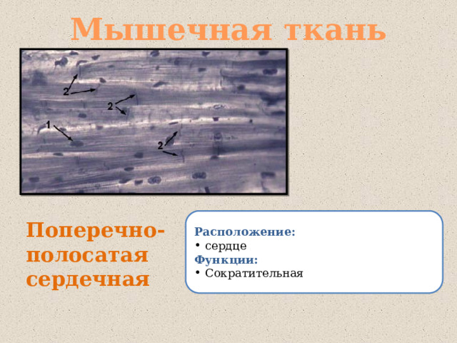 Мышечная ткань Расположение: сердце Функции: Сократительная Поперечно-полосатая сердечная 
