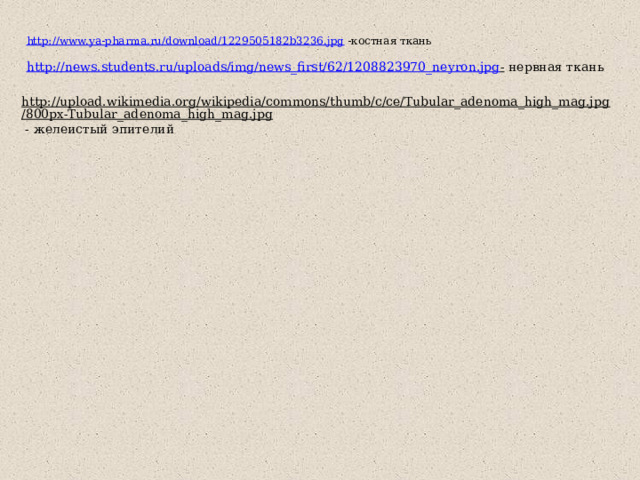 http://www.ya-pharma.ru/download/1229505182b3236.jpg  -костная ткань http://news.students.ru/uploads/img/news_first/62/1208823970_neyron.jpg -  нервная ткань http://upload.wikimedia.org/wikipedia/commons/thumb/c/ce/Tubular_adenoma_high_mag.jpg/800px-Tubular_adenoma_high_mag.jpg  - желеистый эпителий 