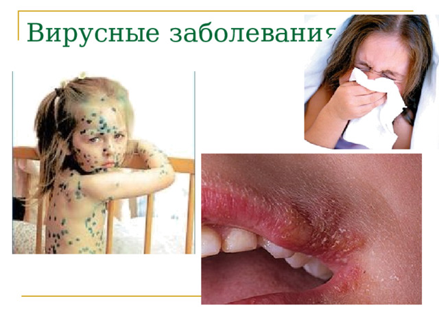 Вирусные заболевания  
