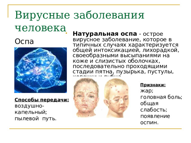 Вирусные заболевания человека  Натуральная оспа - острое вирусное заболевание, которое в типичных случаях характеризуется общей интоксикацией, лихорадкой, своеобразными высыпаниями на коже и слизистых оболочках, последовательно проходящими стадии пятна, пузырька, пустулы, корочки и рубца. Оспа Признаки : жар; головная боль; общая слабость; появление оспин. Способы передачи : воздушно-капельный; пылевой путь. 