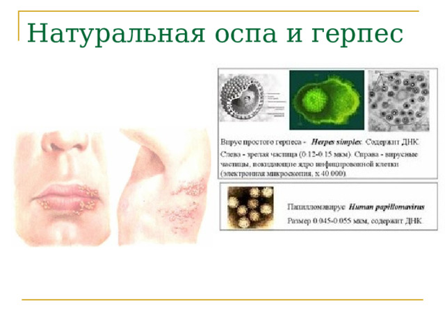 Натуральная оспа  и герпес 