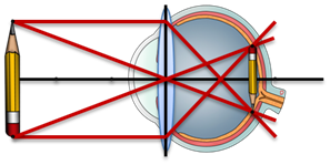 Глаз и зрение физика близорукость