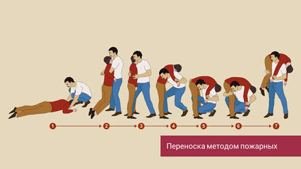 на что следует обратить внимание перед транспортировкой пострадавшего. Смотреть фото на что следует обратить внимание перед транспортировкой пострадавшего. Смотреть картинку на что следует обратить внимание перед транспортировкой пострадавшего. Картинка про на что следует обратить внимание перед транспортировкой пострадавшего. Фото на что следует обратить внимание перед транспортировкой пострадавшего